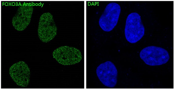 3 - Anti-FoxO3a Rabbit Monoclonal Antibody ABO13818