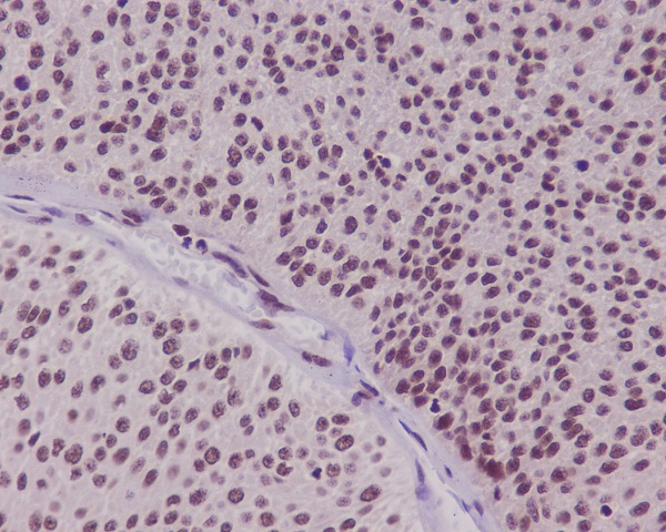 2 - Anti-FoxO3a Rabbit Monoclonal Antibody ABO13818