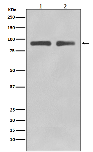 1 - Anti-FoxO3a Rabbit Monoclonal Antibody ABO13818