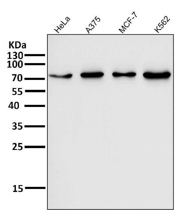1 - Anti-FoxO3a Rabbit Monoclonal Antibody ABO13818