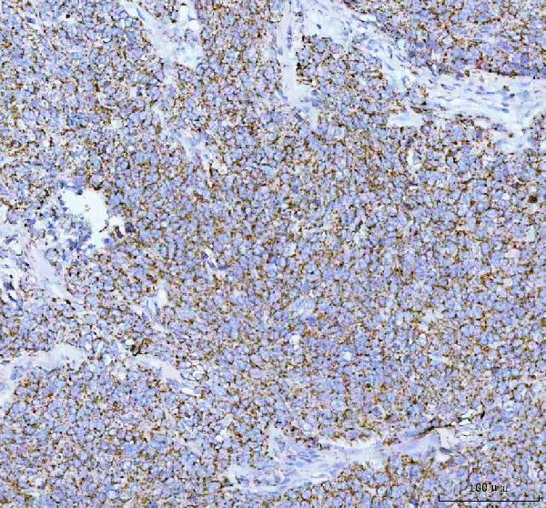 2 - Anti-COX IV COX4I1 Rabbit Monoclonal Antibody ABO13819
