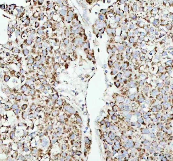2 - Anti-COX IV COX4I1 Rabbit Monoclonal Antibody ABO13819