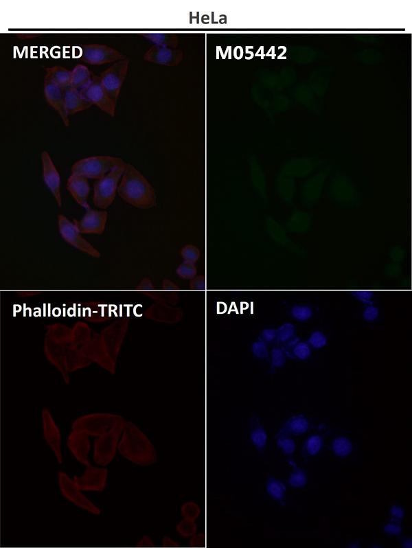 1 - Anti-COX IV COX4I1 Rabbit Monoclonal Antibody ABO13819