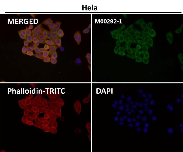 1 - Anti-MEK1/2 MAP2K1 Rabbit Monoclonal Antibody ABO13820