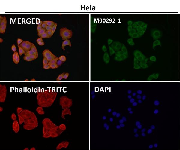 1 - Anti-MEK1/2 MAP2K1 Rabbit Monoclonal Antibody ABO13820