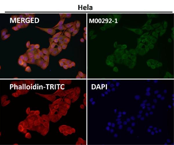 1 - Anti-MEK1/2 MAP2K1 Rabbit Monoclonal Antibody ABO13820
