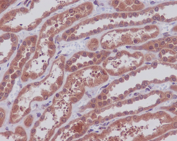 2 - Anti-MEK1/2 MAP2K1 Rabbit Monoclonal Antibody ABO13820