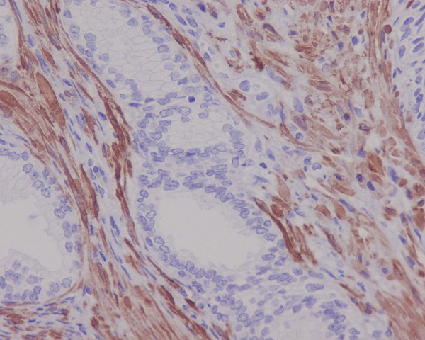 2 - Anti-Desmin Rabbit Monoclonal Antibody ABO13821