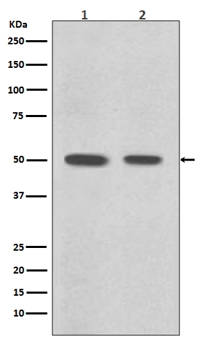 1 - Anti-Desmin Rabbit Monoclonal Antibody ABO13821