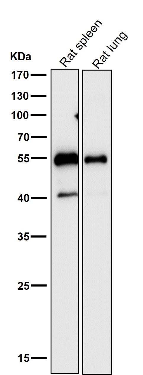 1 - Anti-Desmin Rabbit Monoclonal Antibody ABO13821