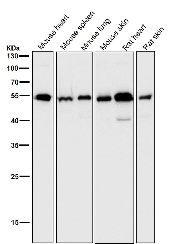 1 - Anti-Desmin Rabbit Monoclonal Antibody ABO13821