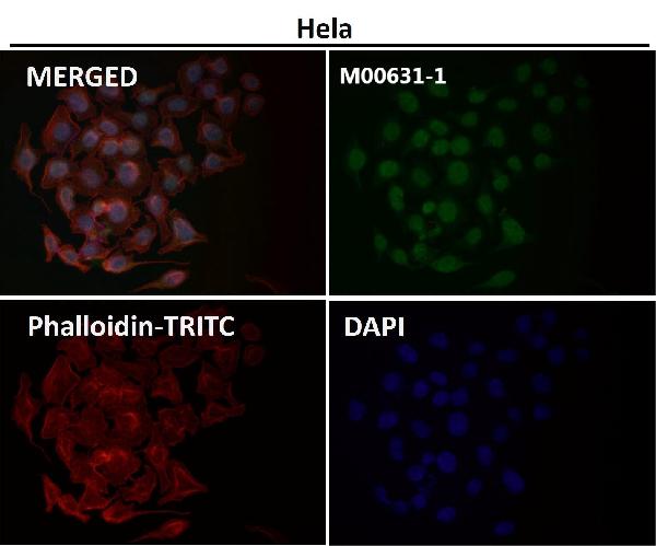 1 - Anti-Sumo 1 Rabbit Monoclonal Antibody ABO13822