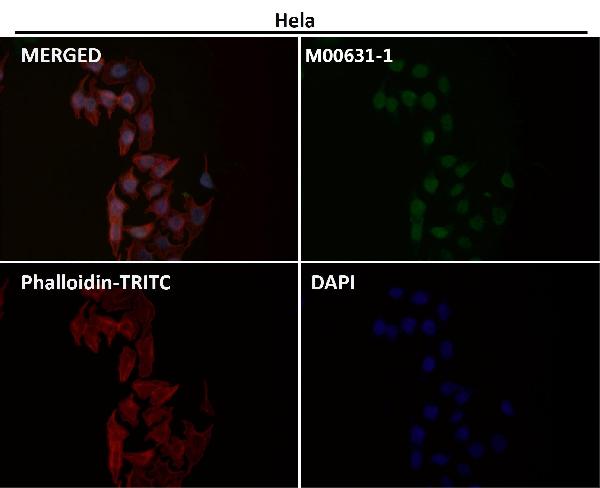 1 - Anti-Sumo 1 Rabbit Monoclonal Antibody ABO13822