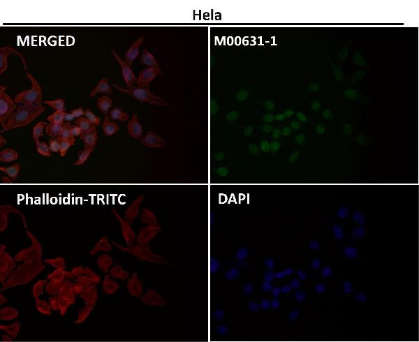 1 - Anti-Sumo 1 Rabbit Monoclonal Antibody ABO13822