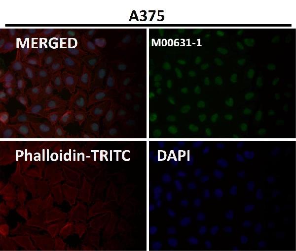 1 - Anti-Sumo 1 Rabbit Monoclonal Antibody ABO13822