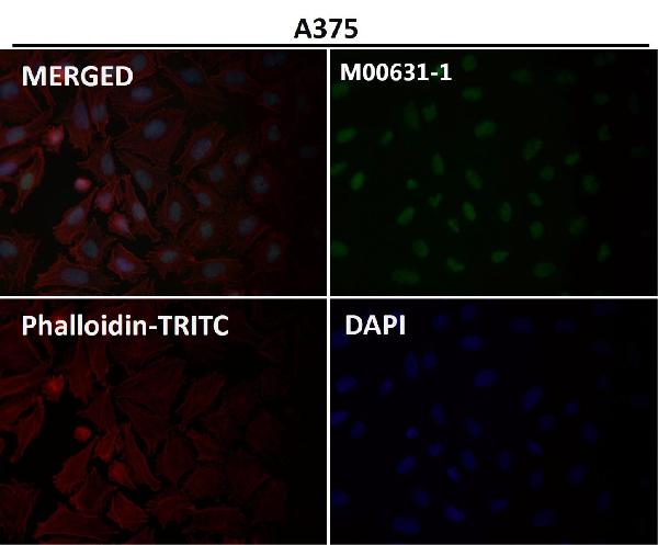 1 - Anti-Sumo 1 Rabbit Monoclonal Antibody ABO13822
