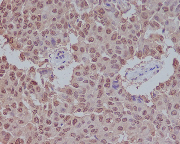 2 - Anti-Sumo 1 Rabbit Monoclonal Antibody ABO13822