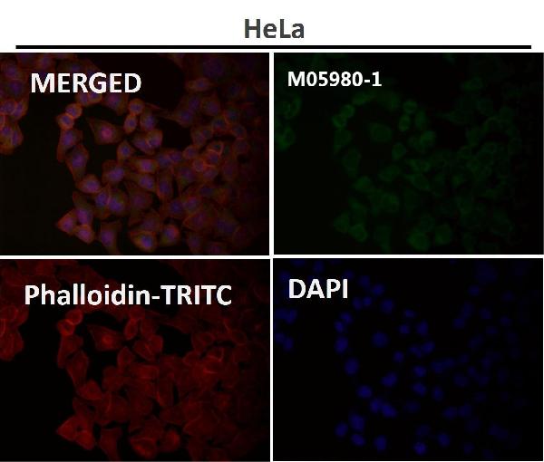 1 - Anti-HAPLN1 Rabbit Monoclonal Antibody ABO13823
