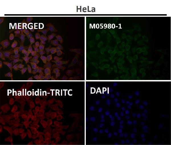 1 - Anti-HAPLN1 Rabbit Monoclonal Antibody ABO13823