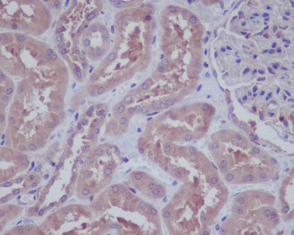 2 - Anti-HAPLN1 Rabbit Monoclonal Antibody ABO13823