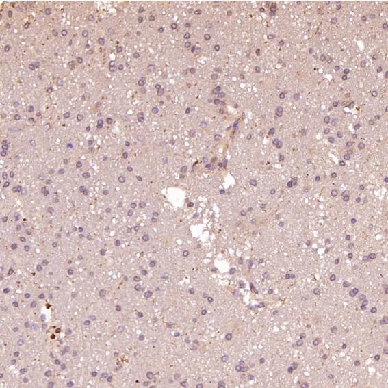 2 - Anti-HAPLN1 Rabbit Monoclonal Antibody ABO13823