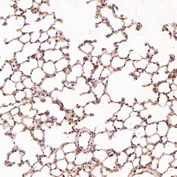 2 - Anti-HAPLN1 Rabbit Monoclonal Antibody ABO13823