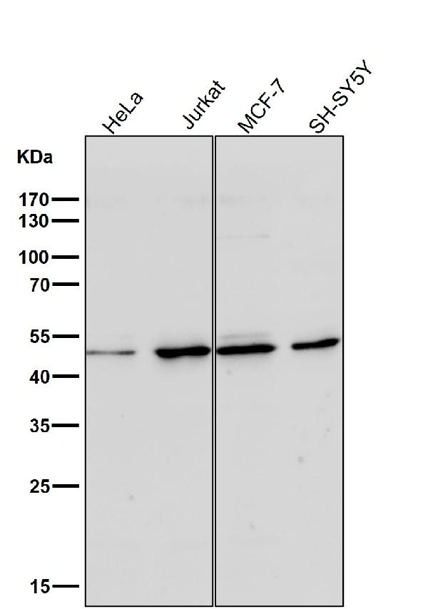 1 - Anti-HAPLN1 Rabbit Monoclonal Antibody ABO13823
