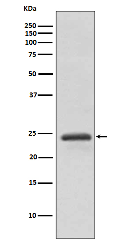 1 - Anti-RAB11A Rabbit Monoclonal Antibody ABO13824