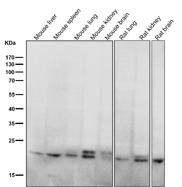 1 - Anti-RAB11A Rabbit Monoclonal Antibody ABO13824