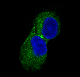 3 - Anti-CaMKII CAMK2B Rabbit Monoclonal Antibody ABO13825