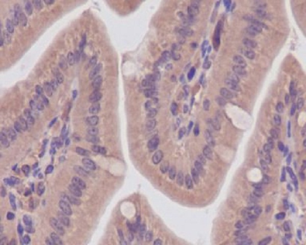 2 - Anti-CaMKII CAMK2B Rabbit Monoclonal Antibody ABO13825