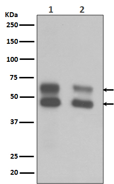 1 - Anti-CaMKII CAMK2B Rabbit Monoclonal Antibody ABO13825