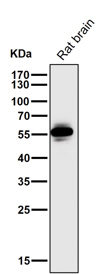 1 - Anti-CaMKII CAMK2B Rabbit Monoclonal Antibody ABO13825