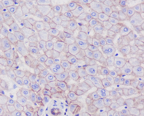 2 - Anti-SCARB1/Sr Bi Rabbit Monoclonal Antibody ABO13826