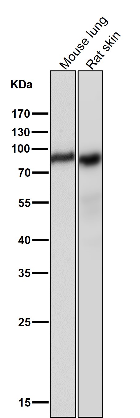 1 - Anti-SCARB1/Sr Bi Rabbit Monoclonal Antibody ABO13826