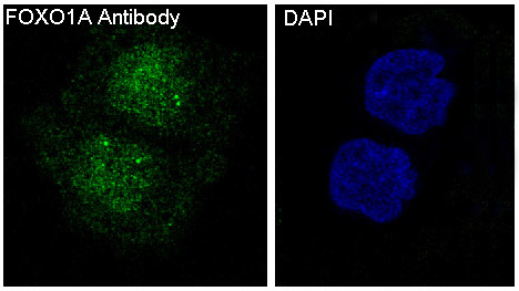 3 - Anti-FoxO1a Rabbit Monoclonal Antibody ABO13827
