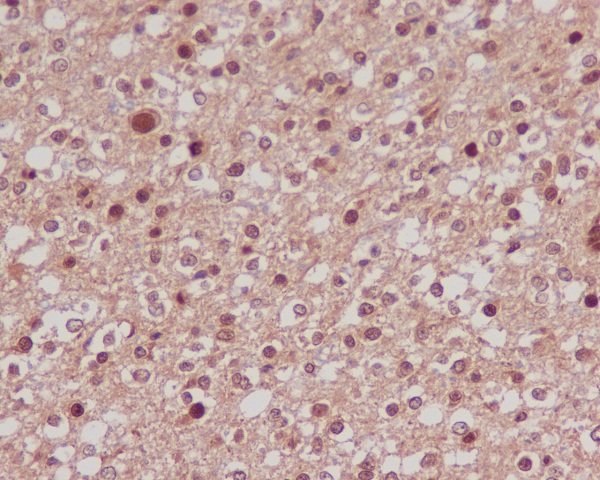2 - Anti-FoxO1a Rabbit Monoclonal Antibody ABO13827