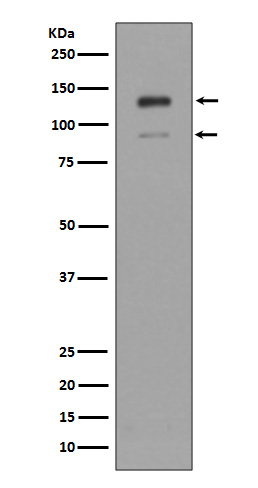 1 - Anti-IFNAR1/Beta R1 Rabbit Monoclonal Antibody ABO13828