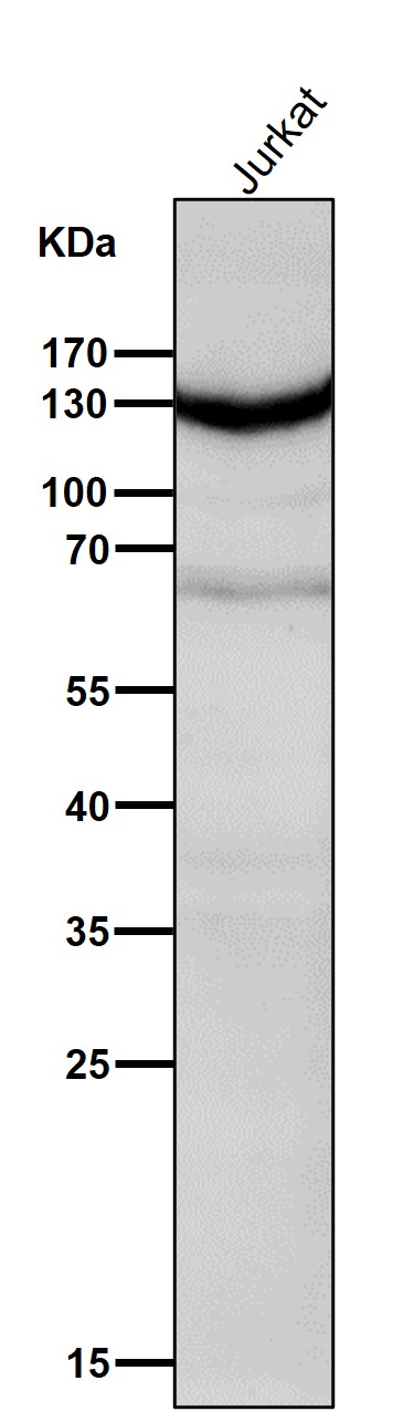 1 - Anti-IFNAR1/Beta R1 Rabbit Monoclonal Antibody ABO13828