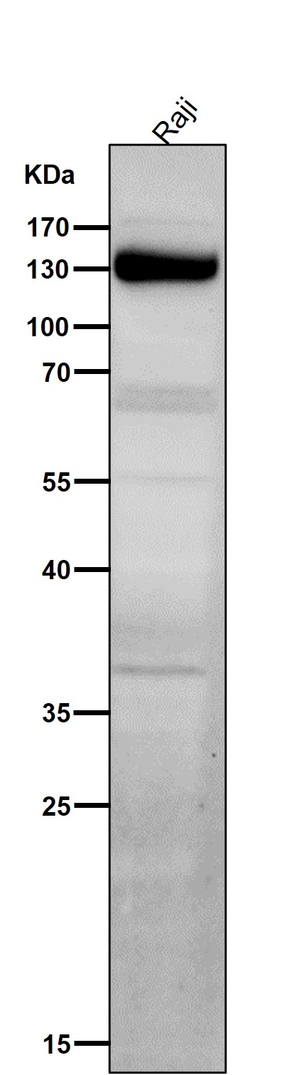 1 - Anti-IFNAR1/Beta R1 Rabbit Monoclonal Antibody ABO13828