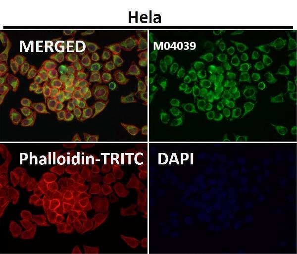 1 - Anti-TOMM20/Tom20 Rabbit Monoclonal Antibody ABO13830