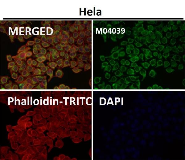 1 - Anti-TOMM20/Tom20 Rabbit Monoclonal Antibody ABO13830