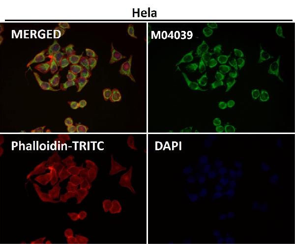 1 - Anti-TOMM20/Tom20 Rabbit Monoclonal Antibody ABO13830