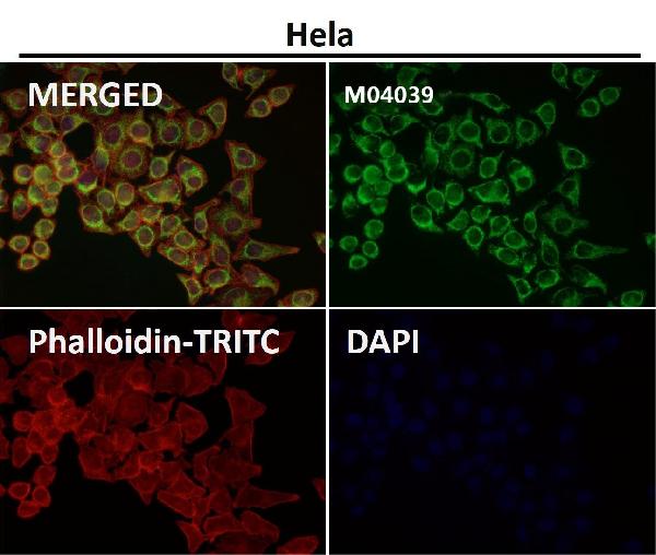 1 - Anti-TOMM20/Tom20 Rabbit Monoclonal Antibody ABO13830