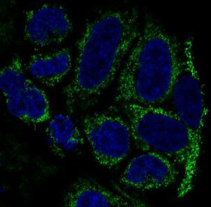 3 - Anti-TOMM20/Tom20 Rabbit Monoclonal Antibody ABO13830
