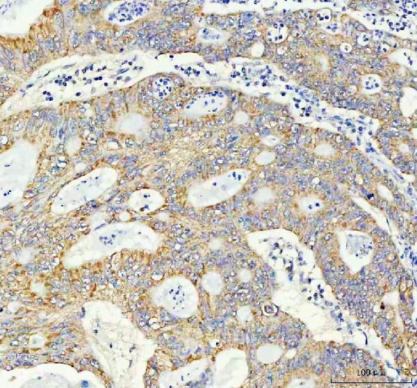 2 - Anti-TOMM20/Tom20 Rabbit Monoclonal Antibody ABO13830