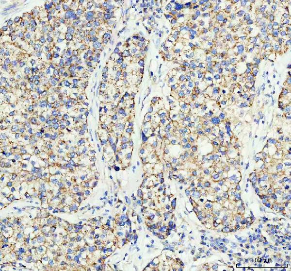 2 - Anti-TOMM20/Tom20 Rabbit Monoclonal Antibody ABO13830