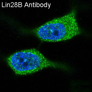 3 - Anti-Lin28B Rabbit Monoclonal Antibody ABO13832