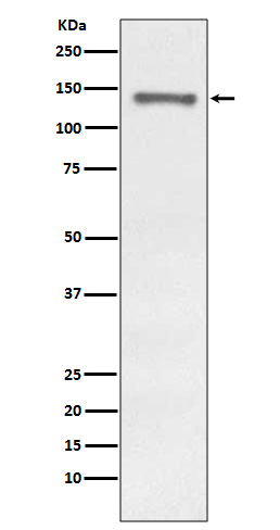 1 - Anti-Raptor RPTOR Rabbit Monoclonal Antibody ABO13836