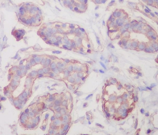 2 - Anti-RALBP1 Rabbit Monoclonal Antibody ABO13838